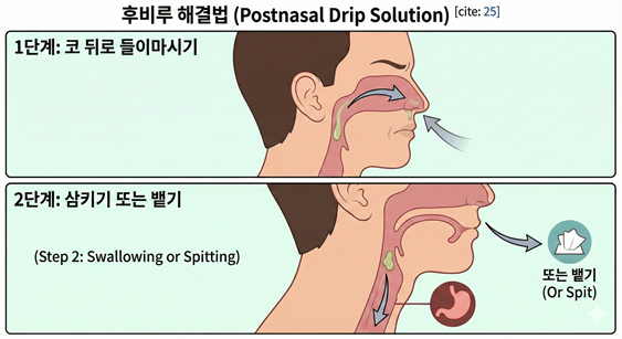 후비루 해결 방법을 두 단계로 보여주는 정보 그래픽. 1단계는 코를 '킁' 하고 뒤로 들이마시는 옆모습, 2단계는 목으로 넘어간 분비물을 삼키거나(위장으로 이동 표시) 휴지에 뱉는 모습(휴지 아이콘)을 선택적으로 보여준다.